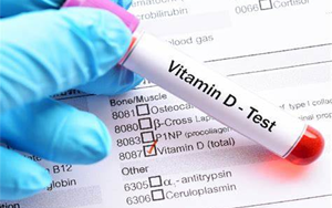 25-羥基維生素D-磁微?；瘜W(xué)發(fā)光法（AE/AP） /熒光免疫層析解決方案（雙抗體夾心法）