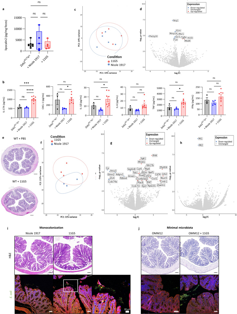 
大腸桿菌11G5感染不會增加Zeb2 IEC-Tg/+小鼠的結(jié)腸炎癥，也不會影響WT同窩小鼠的上皮細胞