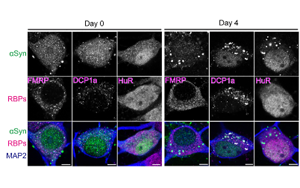 科學家發(fā)現(xiàn)了引發(fā)帕金森病的隱藏RNA結(jié)構(gòu)