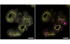Cell：突破類器官研究限制！利用所有關(guān)鍵的胰腺細胞創(chuàng)造了一個新的類器官