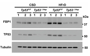 《Nature》脂肪肝為什么會導(dǎo)致肝癌？