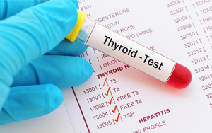  總及游離三碘甲狀腺原氨酸（TT3及FT3）-磁微粒化學發(fā)光法（AE/AP）/熒光免疫層析解決方案（雙抗體夾心法）
