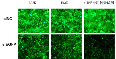 穩(wěn)定表達GFP的HeLa-EGFP細胞，沉默siEGFP，48h后熒光拍照
