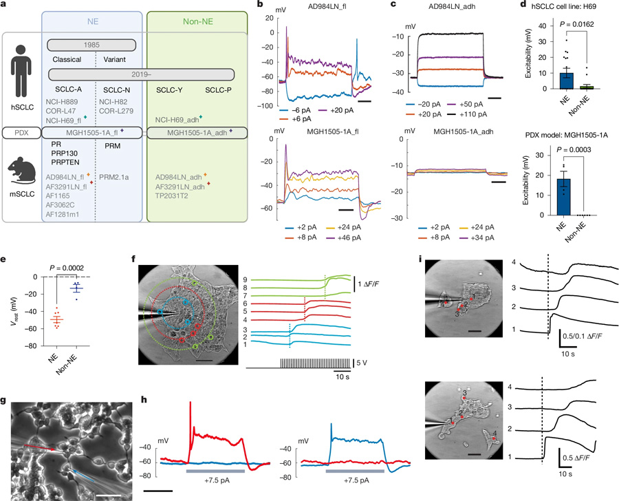 電激活的NE細(xì)胞產(chǎn)生自發(fā)和誘發(fā)的鈣波