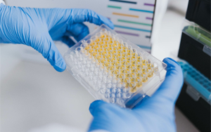 免疫技術(shù)新視界：層析、印跡、吸附與比濁的前沿碰撞