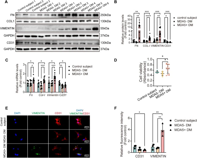 MDA5陽(yáng)性皮肌炎患者血清可誘導(dǎo)原代小鼠肺微血管內(nèi)皮細(xì)胞發(fā)生內(nèi)皮-間質(zhì)轉(zhuǎn)化 MDA5陽(yáng)性皮肌炎患者血清可誘導(dǎo)原代小鼠肺微血管內(nèi)皮細(xì)胞發(fā)生內(nèi)皮-間質(zhì)轉(zhuǎn)化