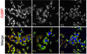 《Nature》細胞的應激反應比科學家認為的更細微、更分散