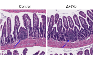 Nature：科學(xué)家新發(fā)現(xiàn)一種免疫細(xì)胞類型，與過敏有關(guān)