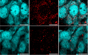 重大發(fā)現(xiàn)！阿爾茨海默病患者來(lái)源的高分子量 tau 蛋白如何 “破壞” 海馬神經(jīng)元？