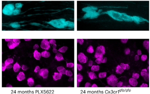 《Nature Neuroscience》大腦白質(zhì)為何隨年齡退化？因?yàn)槊庖呒?xì)胞“勾心斗角”