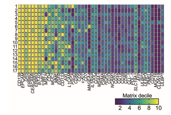 上皮細(xì)胞CAR抗原在結(jié)直腸癌肝轉(zhuǎn)移患者樣本中表達(dá) 上皮細(xì)胞CAR抗原在結(jié)直腸癌肝轉(zhuǎn)移患者樣本中表達(dá)