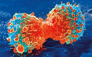 Nature Genetics：腫瘤轉(zhuǎn)移過(guò)程中會(huì)積累更多的拷貝數(shù)變異，而不是突變