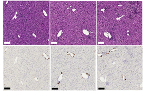 CD4+ T細胞通過激活庫普弗細胞分泌IL-27逆轉HBV誘導的CD8+ T細胞功能障礙的機制研究