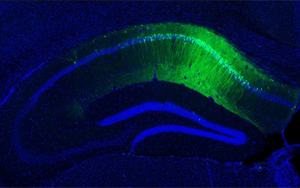 5-羥色胺(5-HT)通過調節(jié)腸道菌群-免疫軸改善加速度暴露誘導的大鼠腸腦軸功能障礙及認知損傷