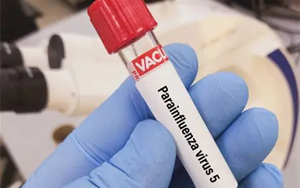 副流感病毒（HPIV1、2、3型）抗原檢測-免疫層析 （膠體金、彩色乳膠及熒光免疫層析）解決方案