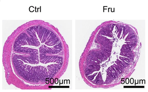 高果糖飲食通過代謝重編程促進效應T細胞生成加劇炎癥反應的作用機制及二甲雙胍干預研究