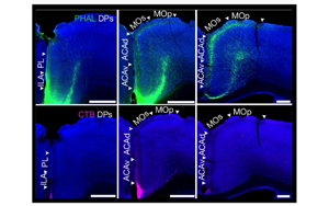 小鼠內(nèi)臟運(yùn)動(dòng)皮層神經(jīng)網(wǎng)絡(luò)的精細(xì)解析與功能調(diào)控機(jī)制研究