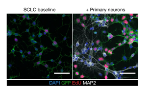 神經(jīng)元活動(dòng)依賴性機(jī)制驅(qū)動(dòng)小細(xì)胞肺癌發(fā)病機(jī)制的新見解