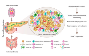 JAMA Oncology：口腔微生物群與胰腺癌風(fēng)險(xiǎn)相關(guān)