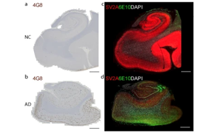 阿爾茨海默病中突觸囊泡蛋白2A在腦組織及胞外囊泡中的減少及其與Aβ、tau和APOEε4的關聯(lián)研究