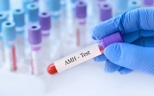 抗繆勒管激素（AMH）-磁微?；瘜W(xué)發(fā)光法（AE/AP） +熒光免疫層析解決方案