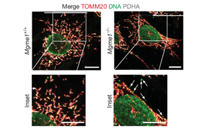 核糖核苷酸滲入線粒體DNA驅(qū)動炎癥反應——揭示核苷酸代謝失衡引發(fā)年齡相關性炎癥的新機制