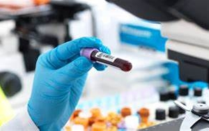 【FAPGG】，血管緊張素轉(zhuǎn)換酶檢測用底物