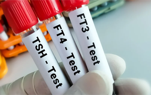 總及游離甲狀腺素（TT4及FT4）-磁微?；瘜W(xué)發(fā)光法（AE/AP）解決方案（雙抗體夾心法）