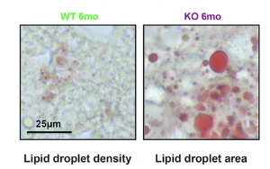 α-酮戊二酸通過調(diào)控胰島素-ATM信號軸改善共濟(jì)失調(diào)毛細(xì)血管擴(kuò)張癥小鼠模型的胰島素抵抗和代謝紊亂