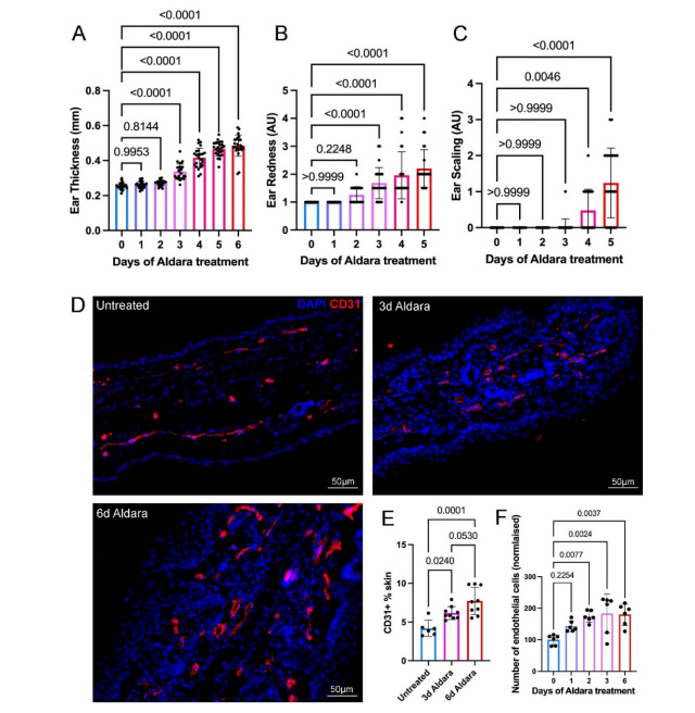 描述銀屑病樣皮膚炎癥過程中炎癥臨床體征與血管系統(tǒng)的變化特征