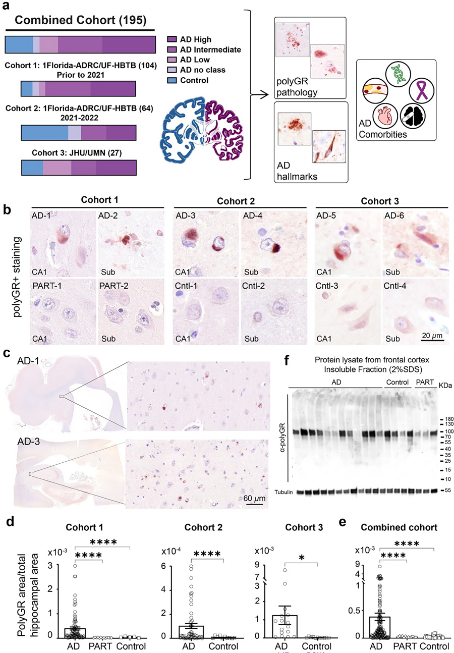 在多組阿爾茨海默病尸檢腦樣本中，海馬體頻繁檢測到PolyGR+?蛋白聚集物