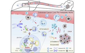 IL33誘導(dǎo)成熟低密度中性粒細(xì)胞脂滴形成驅(qū)動結(jié)直腸癌肝轉(zhuǎn)移的機(jī)制與治療新策略