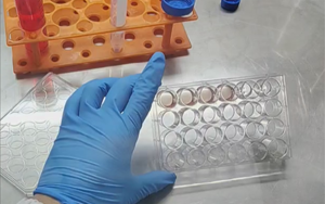 精準(zhǔn)營養(yǎng)，塑造未來：類器官培養(yǎng)基的新紀(jì)元