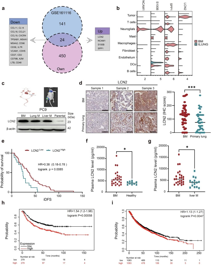 LCN2在腦轉(zhuǎn)移組織中過表達(dá)，且與肺癌患者的不良預(yù)后相關(guān)