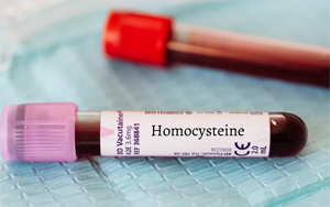 同型半胱氨酸（HCY）-磁微?；瘜W(xué)發(fā)光法（AE/AP） +熒光免疫層析解決方案