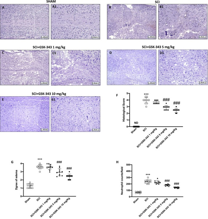 GSK治療改善了脊髓組織損傷