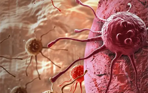 超級增強(qiáng)子導(dǎo)致腫瘤持續(xù)演化并更具侵襲性