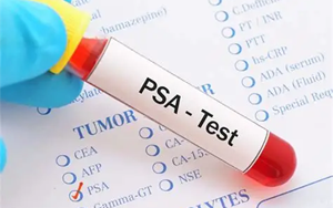 前列腺特異性抗原（tPSA）-磁微粒化學發(fā)光法（AE/AP） /熒光免疫層析解決方案