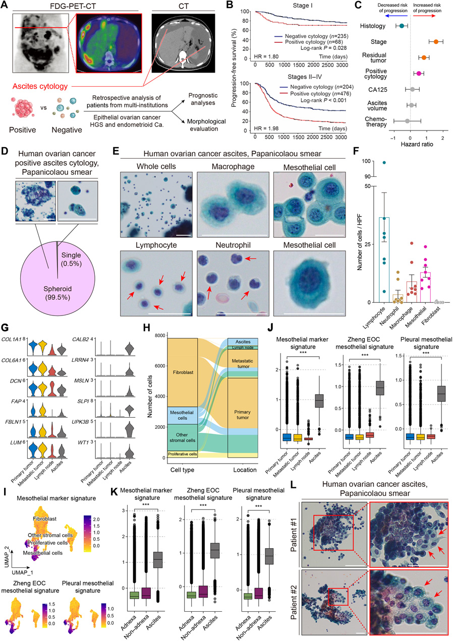 卵巢癌細(xì)胞以球體形式存在，而間皮細(xì)胞是腹水的主要成分
