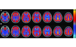 AJCN：要長壽，常吃豆！長期食用大豆飲食可讓大腦“更靈光”