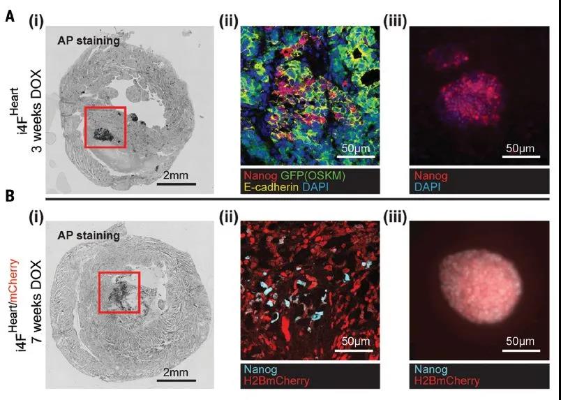 Science重磅：局部重編程讓心肌細(xì)胞“返老還童” 讓心臟實(shí)現(xiàn)再生！