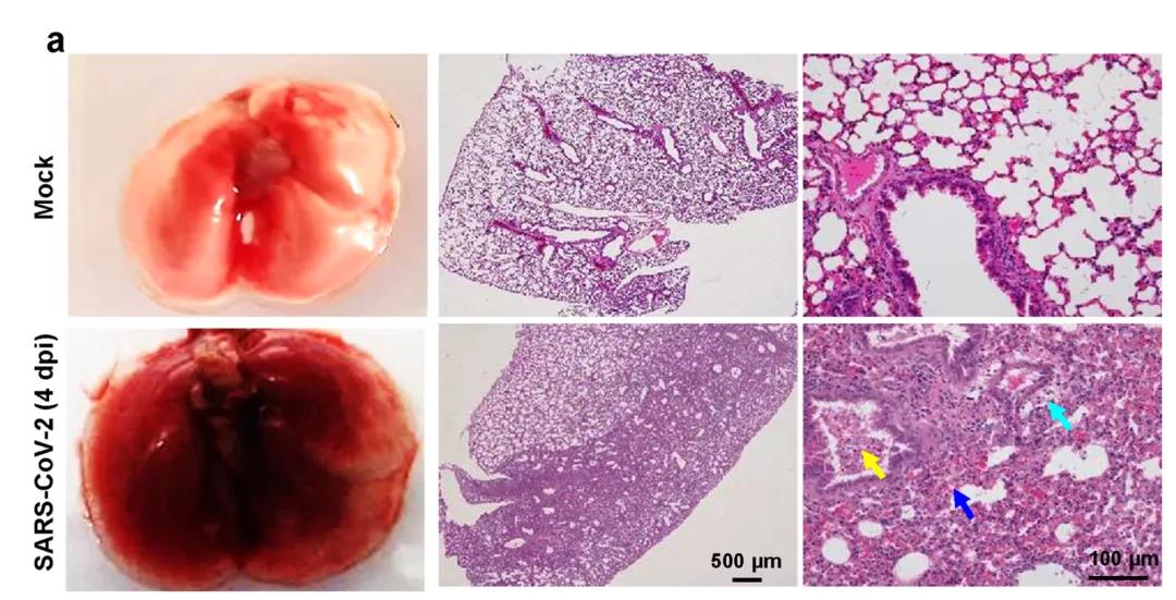 ?建模成功！Nature子刊：成功建立新冠肺炎重癥模型，揭示新冠病毒感染的分子機制