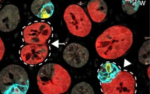 Nature 三連重磅！識(shí)破癌細(xì)胞的“詭計(jì)”，為結(jié)直腸癌患者帶來新希望
