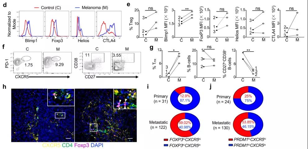 如何重塑腫瘤微環(huán)境，強化抗PD-1療效？Treg細胞的Blimp1表達是關鍵！