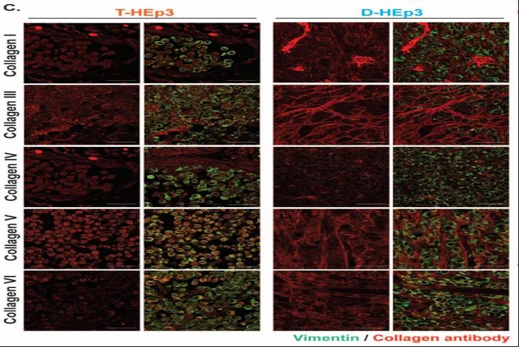 讓癌細(xì)胞“一睡不醒”！向腫瘤微環(huán)境中添加III型膠原蛋白可防止腫瘤復(fù)發(fā)和轉(zhuǎn)移