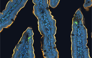 喝完無糖飲料還想吃甜食？人們對糖的渴望，無法被甜味劑替代，答案都在腸道里！