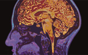 新冠帶來又一挑戰(zhàn)！下一步可能是“癡呆癥浪潮”