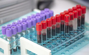 膽堿酯酶（CHE）檢測原料一覽