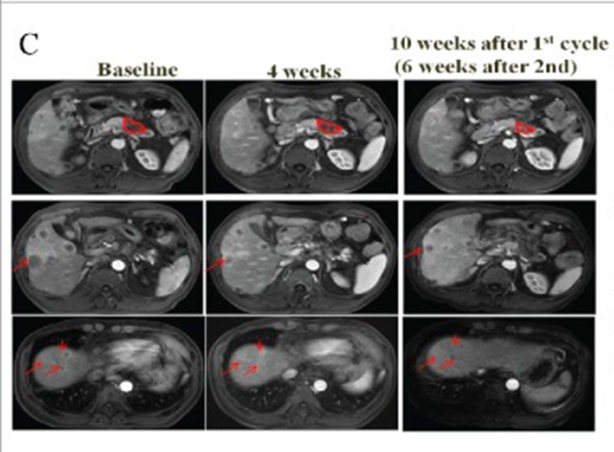 患者治療前后影像學(xué)變化