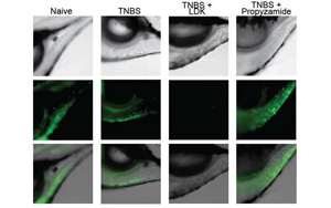 環(huán)境中的化學(xué)物質(zhì)會(huì)增加炎癥性腸病的風(fēng)險(xiǎn)